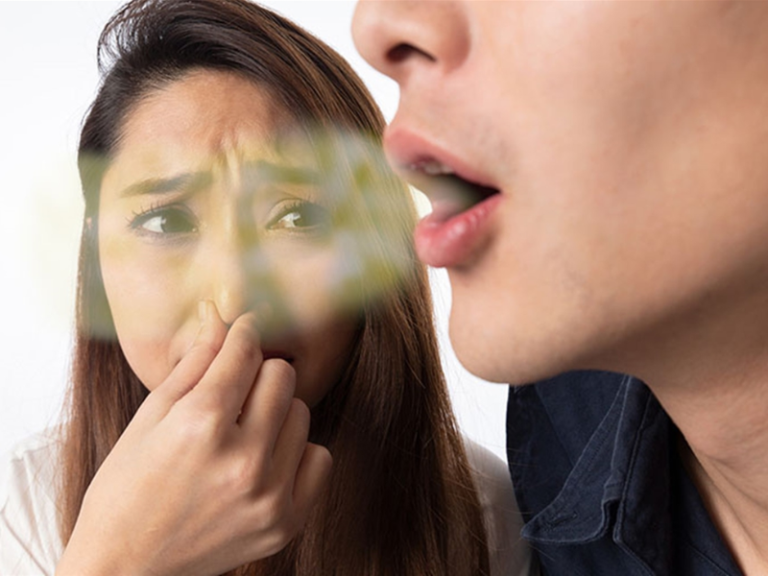 thuốc đặc trị hôi miệng